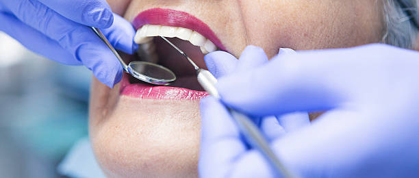 Best Chipped Tooth Repair Near Me  in Rock Island, WA