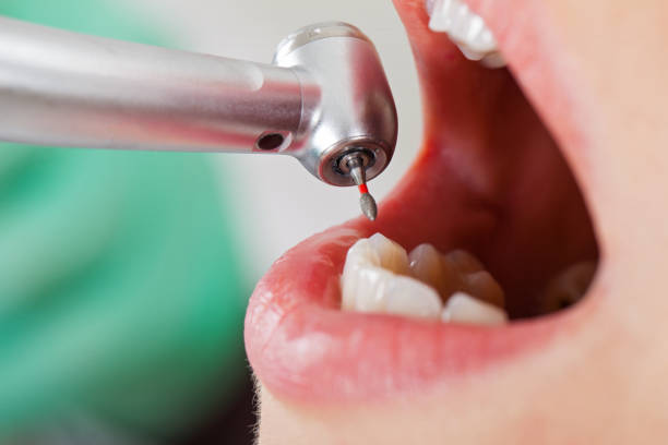 Best Emergency Pediatric Dentist  in Rock Island, WA